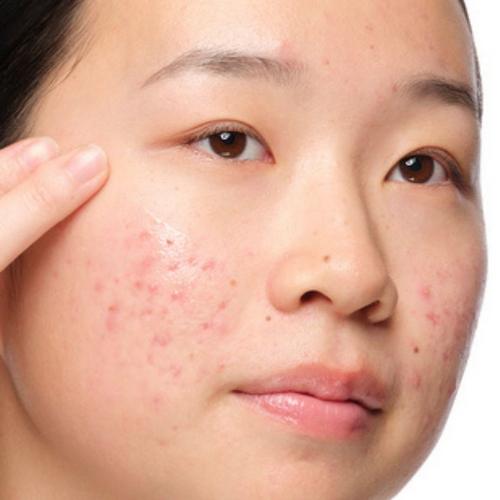 Skincare concern